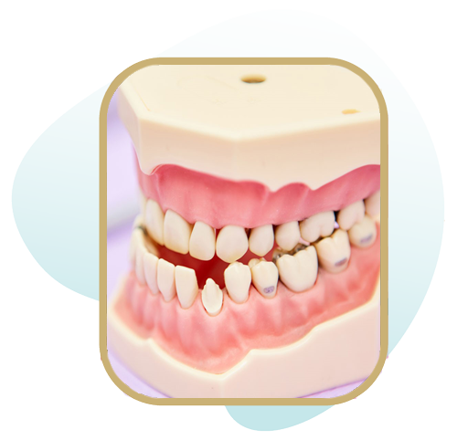درمان ناهنجاری های کراس بایت