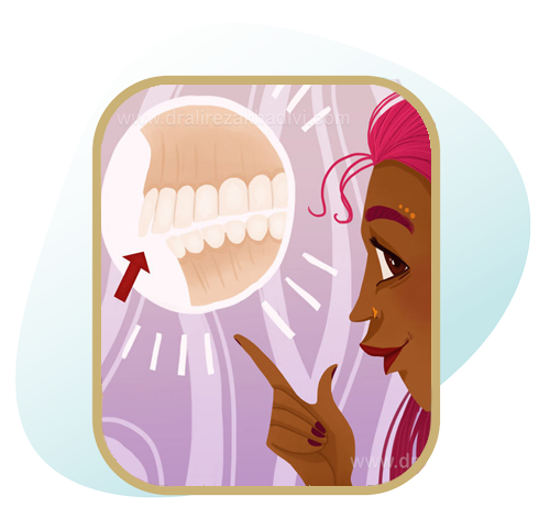 درمان ناهنجاری های اوربایت