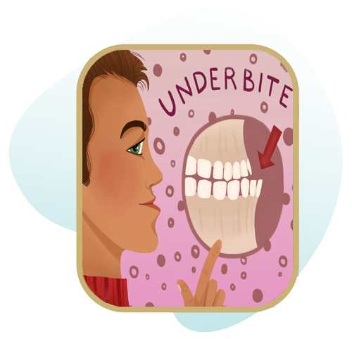 درمان ناهنجاری های آندر بایت